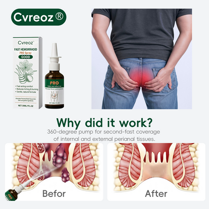 🎁𝙉𝙚𝙬 𝙔𝙚𝙖𝙧 𝙎𝙥𝙚𝙘𝙞𝙖𝙡 𝙊𝙛𝙛𝙚𝙧 | Cvreoz® Fast Hemorrhoid PRO Spray