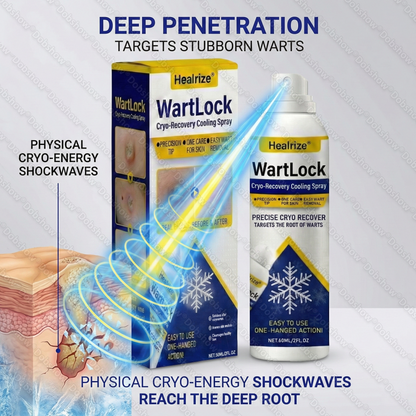 🔥𝙇𝙞𝙢𝙞𝙩𝙚𝙙-𝙩𝙞𝙢𝙚 𝙊𝙛𝙛𝙚𝙧 | Healrize® WartLock Cryo-Recovery Cooling Spray