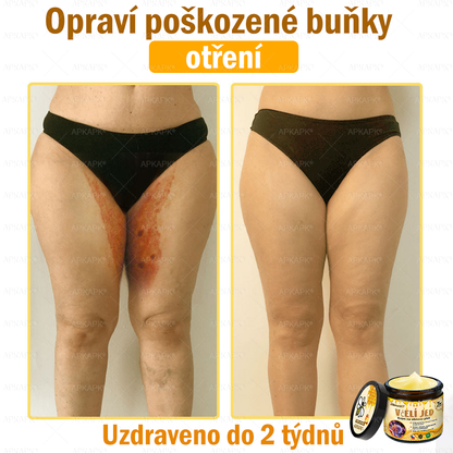 🐝Dermatologicky a klinicky testováno👩‍⚕️APKAPK®Bee Venom Krém na obnovení pleti🐝 pomáhá při léčbě kožních problémů, jako jsou: vrásky, jizvy, pigmentové skvrny, strie, akné, psoriáza, ekzém, kožní změny, podráždění, záněty a další kožní problémy.