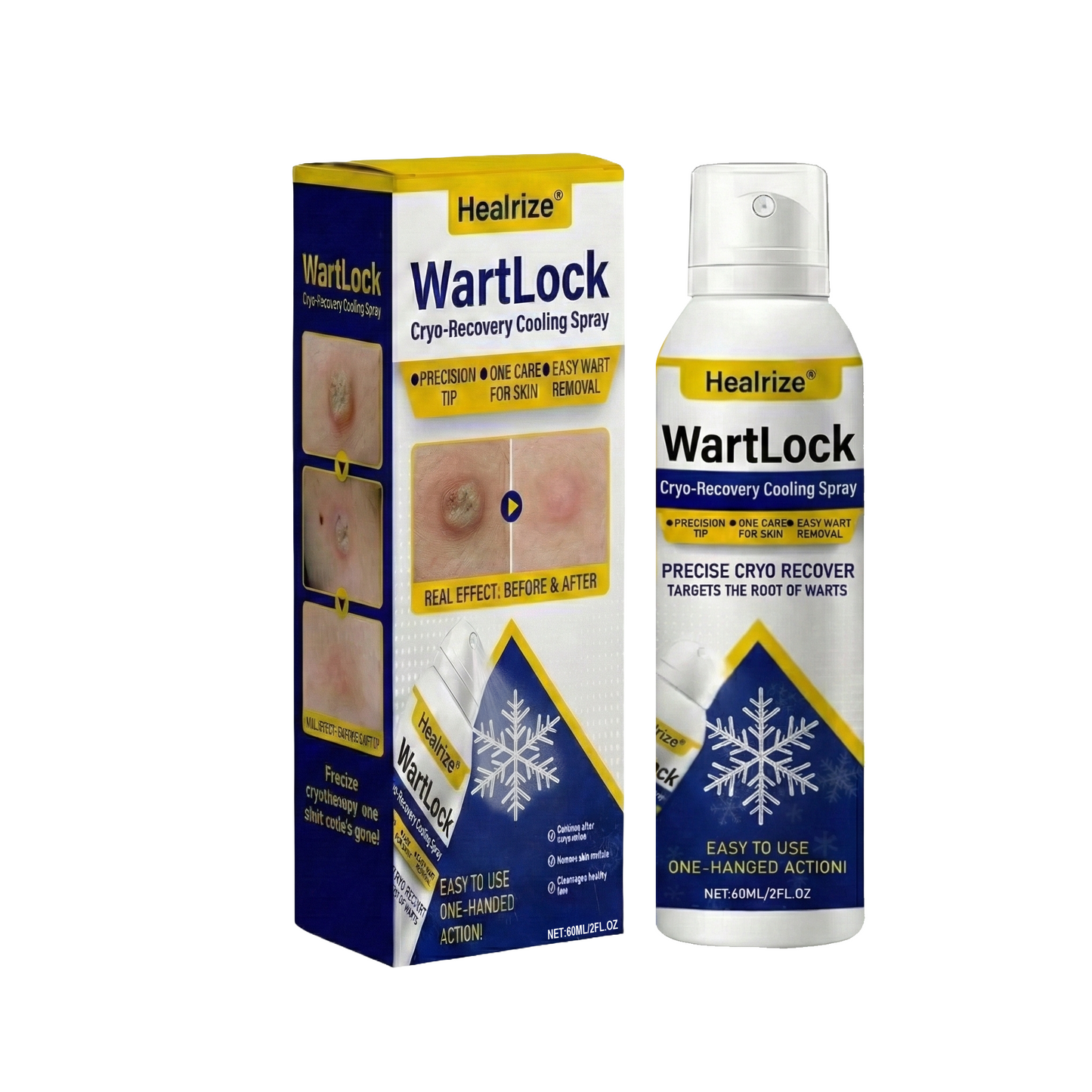 🏅𝙏𝙂𝘼 𝘼𝙥𝙥𝙧𝙤𝙫𝙚𝙙 | Healrize® WartLock Cryo-Recovery Cooling Spray