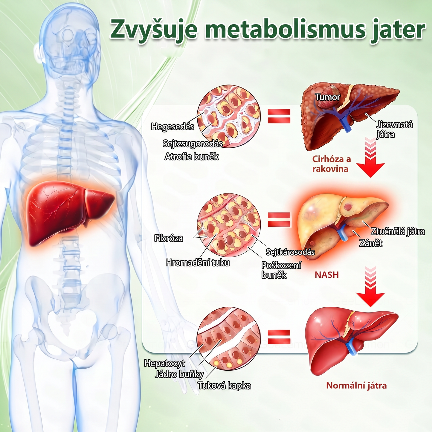🌿Luxarise®Glumasetide 8v1 Stihla a zdrava nano mikrojehlickova naplast(1krát denně – viditelné změny až za 7 dní) ✅Pro obezitu, zpevnění kůže, cukrovku, spánkovou apnoe, klouby atd.