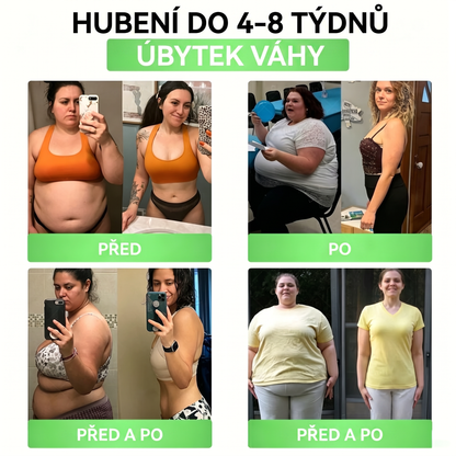 🌿Luxarise®Glumasetide 8v1 Stihla a zdrava nano mikrojehlickova naplast(1krát denně – viditelné změny až za 7 dní) ✅Pro obezitu, zpevnění kůže, cukrovku, spánkovou apnoe, klouby atd.