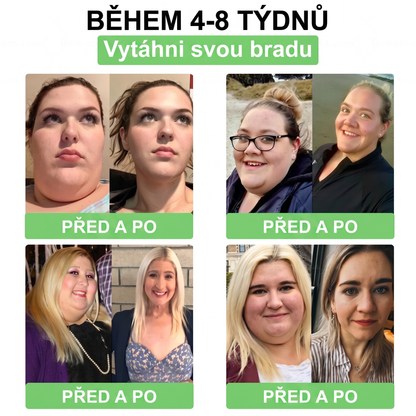🌿Luxarise®Glumasetide 8v1 Stihla a zdrava nano mikrojehlickova naplast(1krát denně – viditelné změny až za 7 dní) ✅Pro obezitu, zpevnění kůže, cukrovku, spánkovou apnoe, klouby atd.