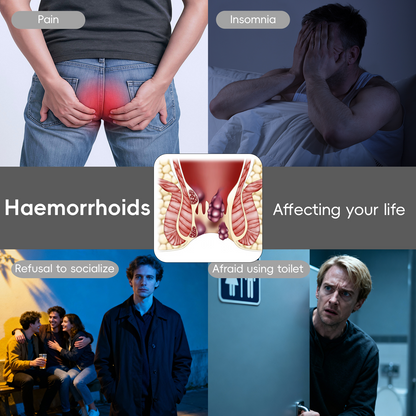 🎁𝙉𝙚𝙬 𝙔𝙚𝙖𝙧 𝙎𝙥𝙚𝙘𝙞𝙖𝙡 𝙊𝙛𝙛𝙚𝙧 | Cvreoz® Fast Hemorrhoid PRO Spray