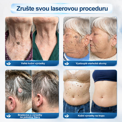 ✅✨𝐎𝐟𝐢𝐜𝐢á𝐥𝐧í 𝐳𝐧𝐚č𝐤𝐨𝐯á 𝐩𝐫𝐨𝐝𝐞𝐣𝐧𝐚  𝐏𝐢𝐜𝐝𝐨® 𝟕𝐝𝐞𝐧𝐧í 𝐨𝐝𝐬𝐭𝐫𝐚ň𝐨𝐯𝐚č   𝐤𝐨ž𝐧í𝐜𝐡 𝐯ý𝐫ů𝐬𝐭𝐤ů 𝐚 𝐬𝐤𝐯𝐫𝐧(Nulová bolest, nulová kulička Rollerball)