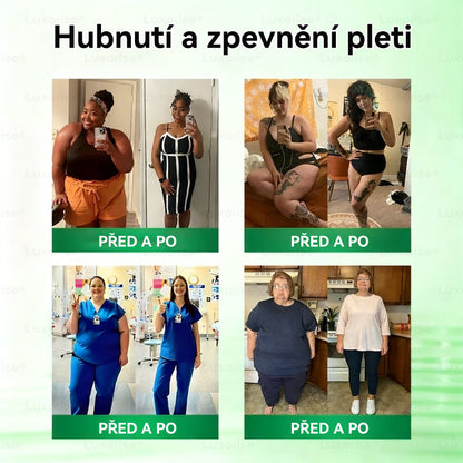 Oficiální obchod  |👩‍⚕️𝗟𝘂𝘅𝗮𝗿𝗶𝘀𝗲® MORINGA X BERBERIN  10-IN-1 Pokročilý Nano Mikrojehly Náplast(Jedna náplast denně, viditelné změny již za 7 dní) ✅ Pomáhá při obezitě, cukrovce, spánkové apnoe, problémech s klouby a dalších potížích💫
