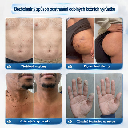 ✅✨𝐎𝐟𝐢𝐜𝐢á𝐥𝐧í 𝐳𝐧𝐚č𝐤𝐨𝐯á 𝐩𝐫𝐨𝐝𝐞𝐣𝐧𝐚  𝐏𝐢𝐜𝐝𝐨® 𝟕𝐝𝐞𝐧𝐧í 𝐨𝐝𝐬𝐭𝐫𝐚ň𝐨𝐯𝐚č   𝐤𝐨ž𝐧í𝐜𝐡 𝐯ý𝐫ů𝐬𝐭𝐤ů 𝐚 𝐬𝐤𝐯𝐫𝐧(Nulová bolest, nulová kulička Rollerball)