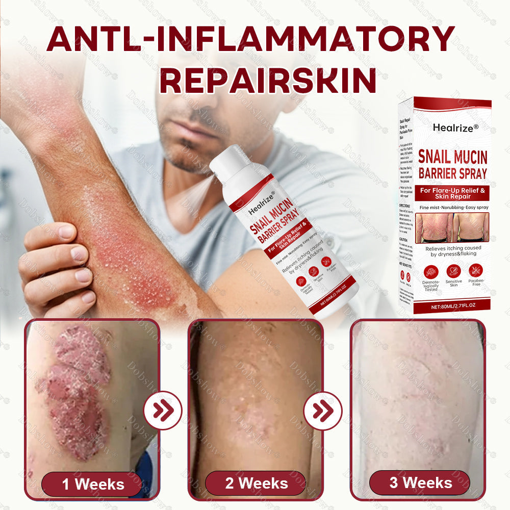 🔥𝙈𝙖𝙧𝙘𝙝 𝙎𝙥𝙚𝙘𝙞𝙖𝙡 𝙊𝙛𝙛𝙚𝙧𝙨 | Healrize® Snail Mucin Barrier Spray for Flare-Up Relief & Skin Repair