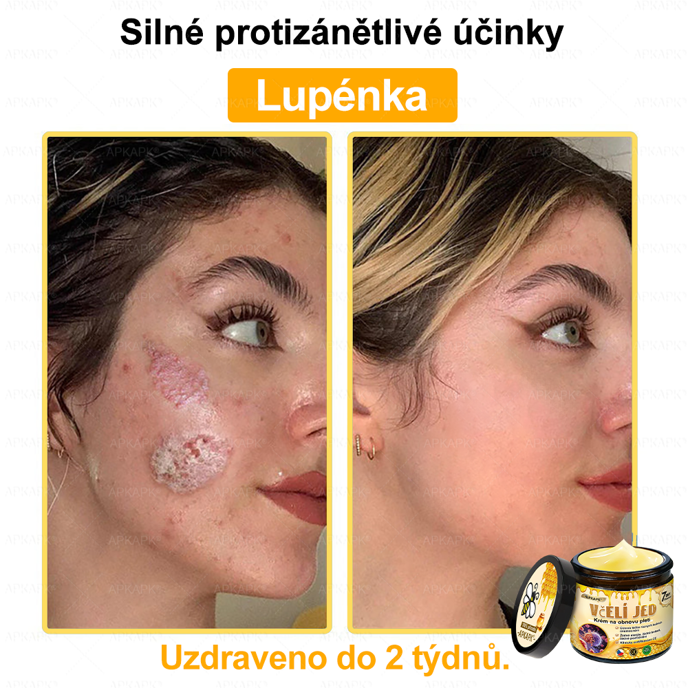 🐝Dermatologicky a klinicky testováno👩‍⚕️APKAPK®Bee Venom Krém na obnovení pleti🐝 pomáhá při léčbě kožních problémů, jako jsou: vrásky, jizvy, pigmentové skvrny, strie, akné, psoriáza, ekzém, kožní změny, podráždění, záněty a další kožní problémy.