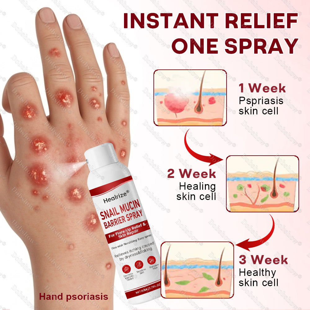 🔥𝙈𝙖𝙧𝙘𝙝 𝙎𝙥𝙚𝙘𝙞𝙖𝙡 𝙊𝙛𝙛𝙚𝙧𝙨 | Healrize® Snail Mucin Barrier Spray for Flare-Up Relief & Skin Repair