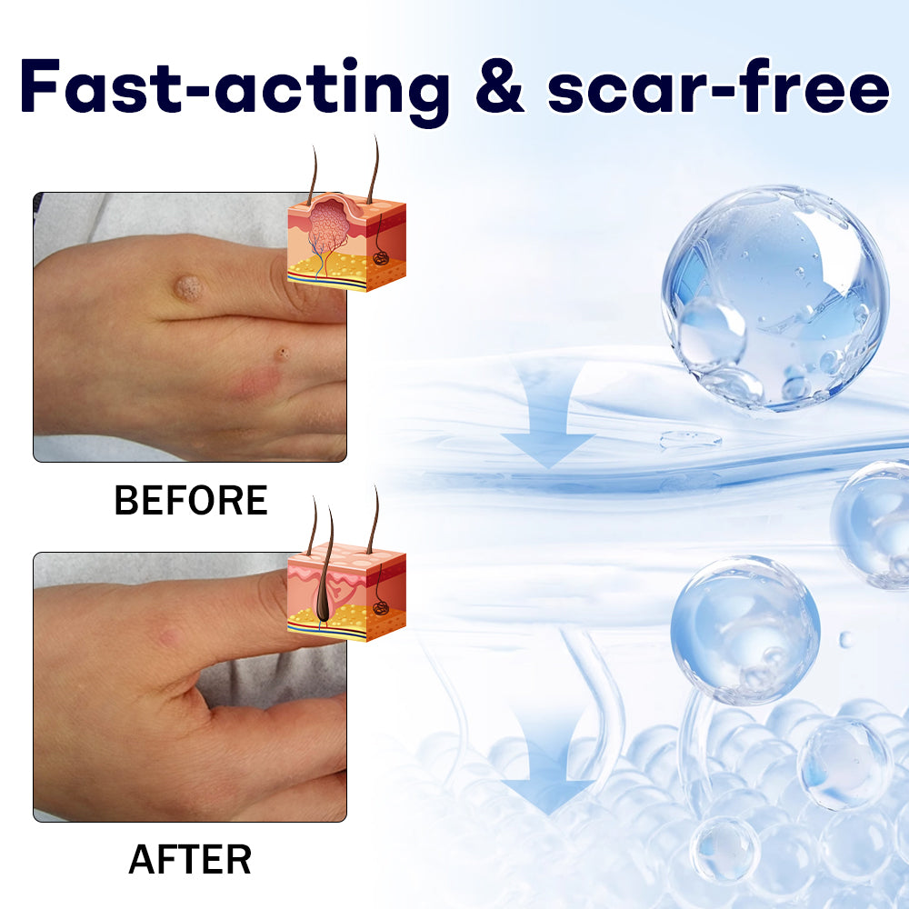 🎅 𝘾𝙝𝙧𝙞𝙨𝙩𝙢𝙖𝙨 𝙎𝙖𝙡𝙚 | AAFQ® WartLock CRYO RECOVERY SPRAY