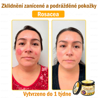 🐝Dermatologicky a klinicky testováno👩‍⚕️APKAPK®Bee Venom Krém na obnovení pleti🐝 pomáhá při léčbě kožních problémů, jako jsou: vrásky, jizvy, pigmentové skvrny, strie, akné, psoriáza, ekzém, kožní změny, podráždění, záněty a další kožní problémy.