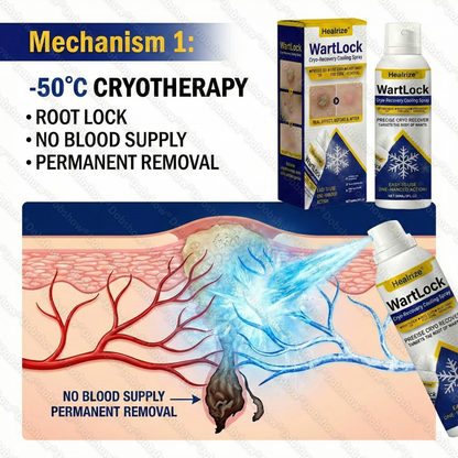 🔥𝙇𝙞𝙢𝙞𝙩𝙚𝙙-𝙩𝙞𝙢𝙚 𝙊𝙛𝙛𝙚𝙧 | Healrize® WartLock Cryo-Recovery Cooling Spray