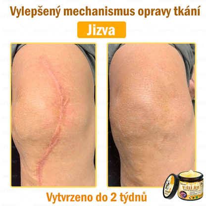 🐝Dermatologicky a klinicky testováno👩‍⚕️APKAPK®Bee Venom Krém na obnovení pleti🐝 pomáhá při léčbě kožních problémů, jako jsou: vrásky, jizvy, pigmentové skvrny, strie, akné, psoriáza, ekzém, kožní změny, podráždění, záněty a další kožní problémy.