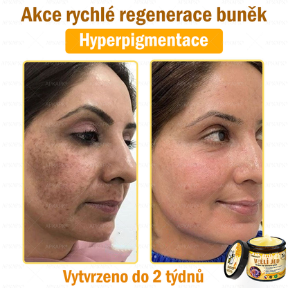 🐝Dermatologicky a klinicky testováno👩‍⚕️APKAPK®Bee Venom Krém na obnovení pleti🐝 pomáhá při léčbě kožních problémů, jako jsou: vrásky, jizvy, pigmentové skvrny, strie, akné, psoriáza, ekzém, kožní změny, podráždění, záněty a další kožní problémy.